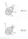 Fig. 55 - Electrosurgical device and methods