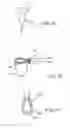 Fig. 56 - Electrosurgical device and methods
