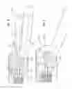 Fig. 07 - Cordless medical cauterization and cutting device