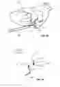 Fig. 09 - Method and devices for coagulation of tissue