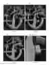 Fig. 06 - Catheter device for transmitting and reflecting light