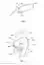 Fig. 04 - System and method for optimal catheter selection for individual patient anatomy
