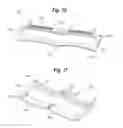 Fig. 04 - Skin Tensioning Devices and Methods of Their Use