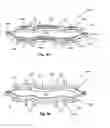 Fig. 06 - Skin Tensioning Devices and Methods of Their Use