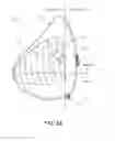Fig. 07 - TISSUE EXPANDERS AND METHODS OF USE