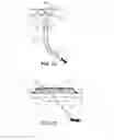 Fig. 22 - TISSUE EXPANDERS AND METHODS OF USE