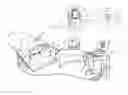 Fig. 01 - Catheter stability indication