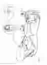 Fig. 02 - Catheter stability indication