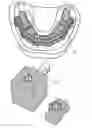 Fig. 02 - Method for producing a dental drilling template