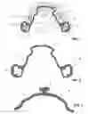 Fig. 02 - Orthodontic apparatus and method for producing an orthodontic apparatus