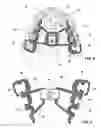 Fig. 03 - Orthodontic apparatus and method for producing an orthodontic apparatus