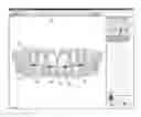 Fig. 01 - Software And Methods For Dental Treatment Planning