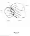 Fig. 22 - Preventing interference between tooth models