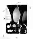 Fig. 02 - Orthodontic appliance for distalization and/or space closure