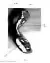 Fig. 05 - Orthodontic appliance for distalization and/or space closure