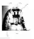 Fig. 07 - Orthodontic appliance for distalization and/or space closure