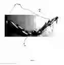 Fig. 10 - Orthodontic appliance for distalization and/or space closure