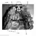 Fig. 13 - Orthodontic appliance for distalization and/or space closure