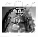 Fig. 15 - Orthodontic appliance for distalization and/or space closure
