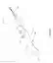 Fig. 02 - APPARATUS FOR TOOTH STAIN REMOVAL