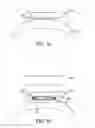 Fig. 02 - Method of diagnosing optical inhomogeneity of a volume scattering object and a dental tool