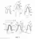 Fig. 04 - Method of diagnosing optical inhomogeneity of a volume scattering object and a dental tool