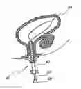 Fig. 01 - Attenuation device for use in an anatomical structure