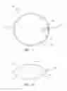 Fig. 06 - Attenuation device for use in an anatomical structure