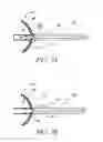 Fig. 08 - Attenuation device for use in an anatomical structure