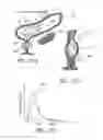 Fig. 24 - Attenuation device for use in an anatomical structure