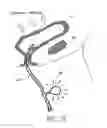 Fig. 27 - Attenuation device for use in an anatomical structure