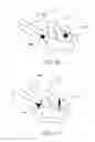 Fig. 43 - Attenuation device for use in an anatomical structure