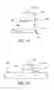 Fig. 45 - Attenuation device for use in an anatomical structure