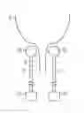 Fig. 01 - METHOD AND APPARATUS FOR FIXATION OF IMPLANTABLE DEVICES ADJACENT A BODY LUMEN