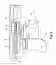 Fig. 03 - Tools and methods for treatment of pelvic conditions