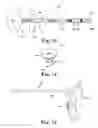Fig. 10 - Tools and methods for treatment of pelvic conditions