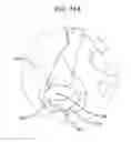 Fig. 14 - BIOABSORBABLE MULTILAYER NASAL VALVE SPREADER GRAFT