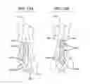 Fig. 16 - BIOABSORBABLE MULTILAYER NASAL VALVE SPREADER GRAFT
