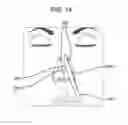 Fig. 17 - BIOABSORBABLE MULTILAYER NASAL VALVE SPREADER GRAFT