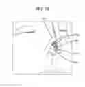 Fig. 19 - BIOABSORBABLE MULTILAYER NASAL VALVE SPREADER GRAFT