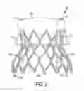 Fig. 03 - Prosthetic valve with sealing members and methods of use thereof