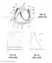 Fig. 02 - Replacement heart valves and their methods of use and manufacture