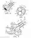 Fig. 03 - Methods and apparatus for percutaneous aortic valve replacement