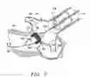 Fig. 04 - Methods and apparatus for percutaneous aortic valve replacement