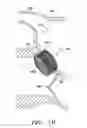 Fig. 06 - Methods and apparatus for percutaneous aortic valve replacement