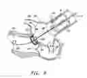 Fig. 07 - Methods and apparatus for percutaneous aortic valve replacement