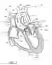 Fig. 03 - Method of treating a patient using a retrievable transcatheter prosthetic heart valve
