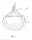 Fig. 11 - Method of treating a patient using a retrievable transcatheter prosthetic heart valve