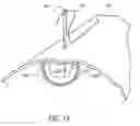 Fig. 21 - Method of treating a patient using a retrievable transcatheter prosthetic heart valve