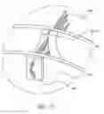 Fig. 22 - Method of treating a patient using a retrievable transcatheter prosthetic heart valve